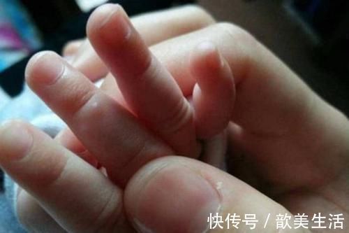 部位|孩子这3个部位越“短”,长大个子越矮!宝妈们早知早受益