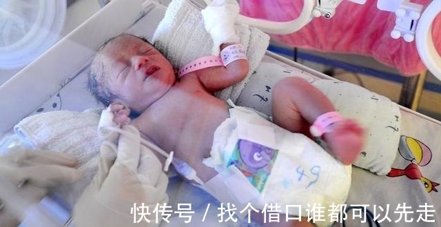 生命|70厘米高的孕妇冒生命危险产下女婴,婴儿出生后丈夫却泣不成声