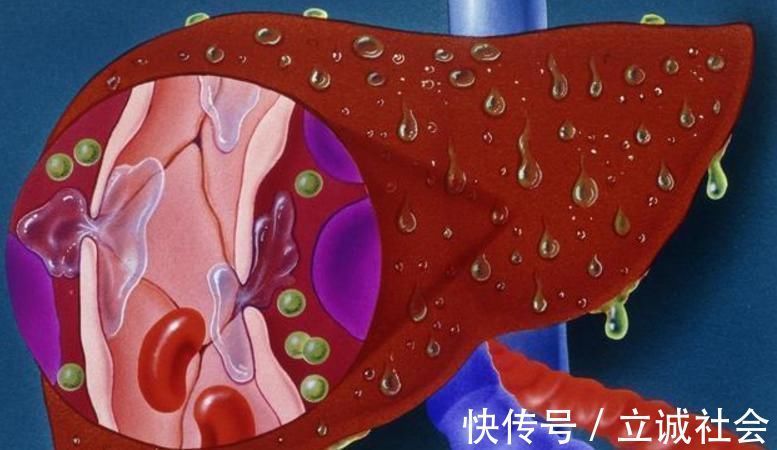 肝病|肝脏有问题的人,日常多吃此4物,能养肝护肝,或远离肝病