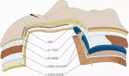 苹果肌|30支玻尿酸,会给你的脸带来怎样翻天覆地的变化?
