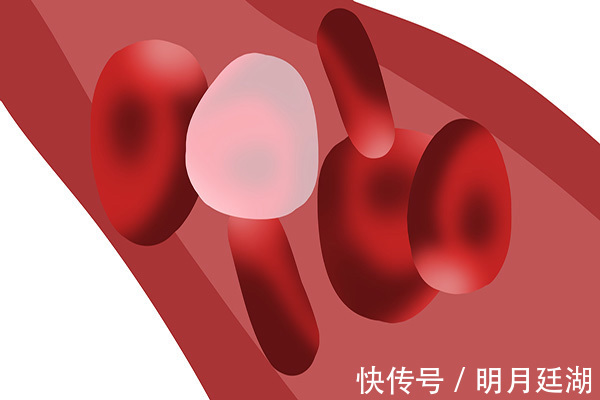 女性|女性到更年期会累、疼、潮是怎么回事若你也有，说明更年期来了