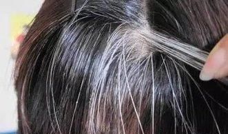  越来越|白头发越来越多? 这样做, 让头发重返乌黑亮丽