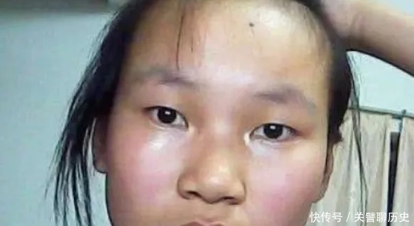 满面|青春期女孩总是“油光满面”？坚持3小事，从此做个“哑光美人”