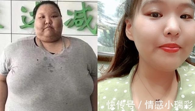 女孩|95后女孩体重400斤,睡觉时把床压塌,现在她的变化让无数人惊叹