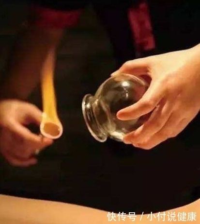 毒素|拔完罐后身上的淤青是身体排出的毒素吗?看看老中医是怎么说的