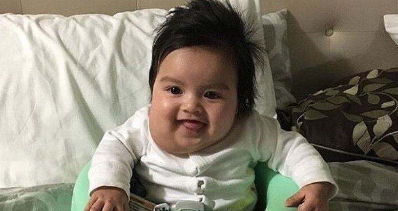 侏儒症|产检一切正常的新生儿多一个手指,爸爸要求医院赔偿,医生表示很冤枉