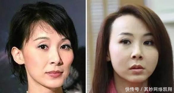 垮掉|明星都爱打玻尿酸, 但你一定没看过她们脸垮掉的样子