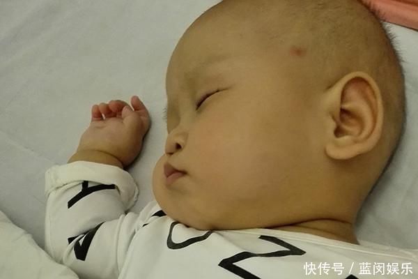 宝宝|为啥有的宝宝出生后,身上会有胎记医生原因可能令你意外