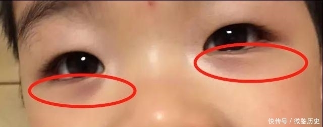 山楂|食疗“消食冠军”，效果是山楂的8倍，消积食健脾胃，孩子可常喝