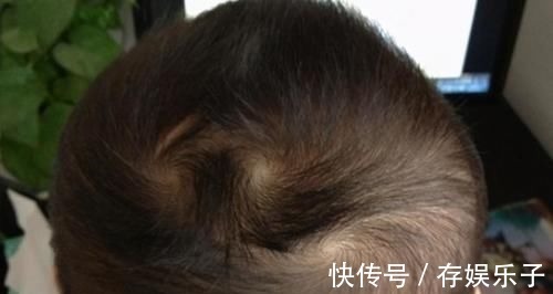 小伟|孩子头顶几个旋暗示着什么?别乱猜,科学的解释爸妈要牢记