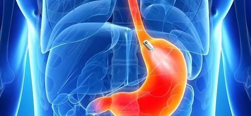 福音|慢性胃炎的“福音”来了，每天吃一点，抑菌消炎，保护胃黏膜！