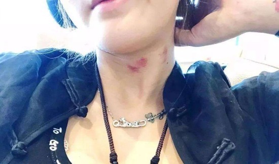 夫妻|夫妻亲热时，女性有几个部位不能吻，给不知道的男人提个醒