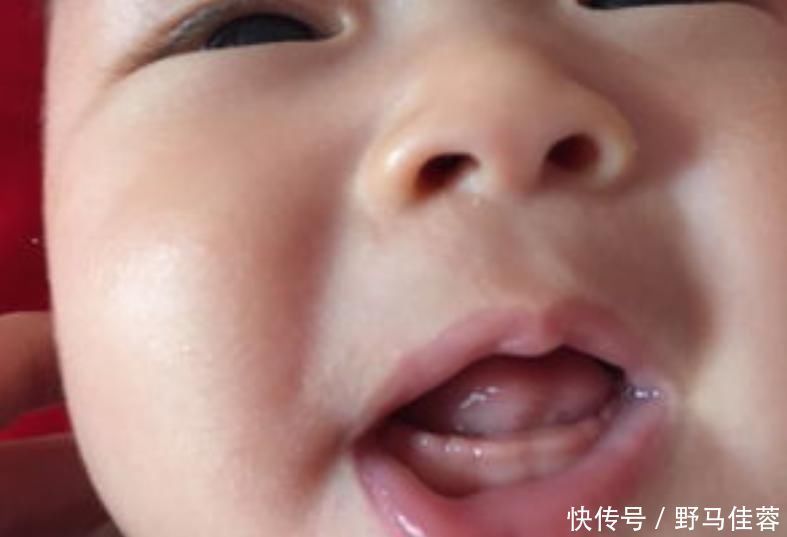 维生素d|婴幼儿什么时候长牙?这5个“信号”告诉妈妈:我长牙了