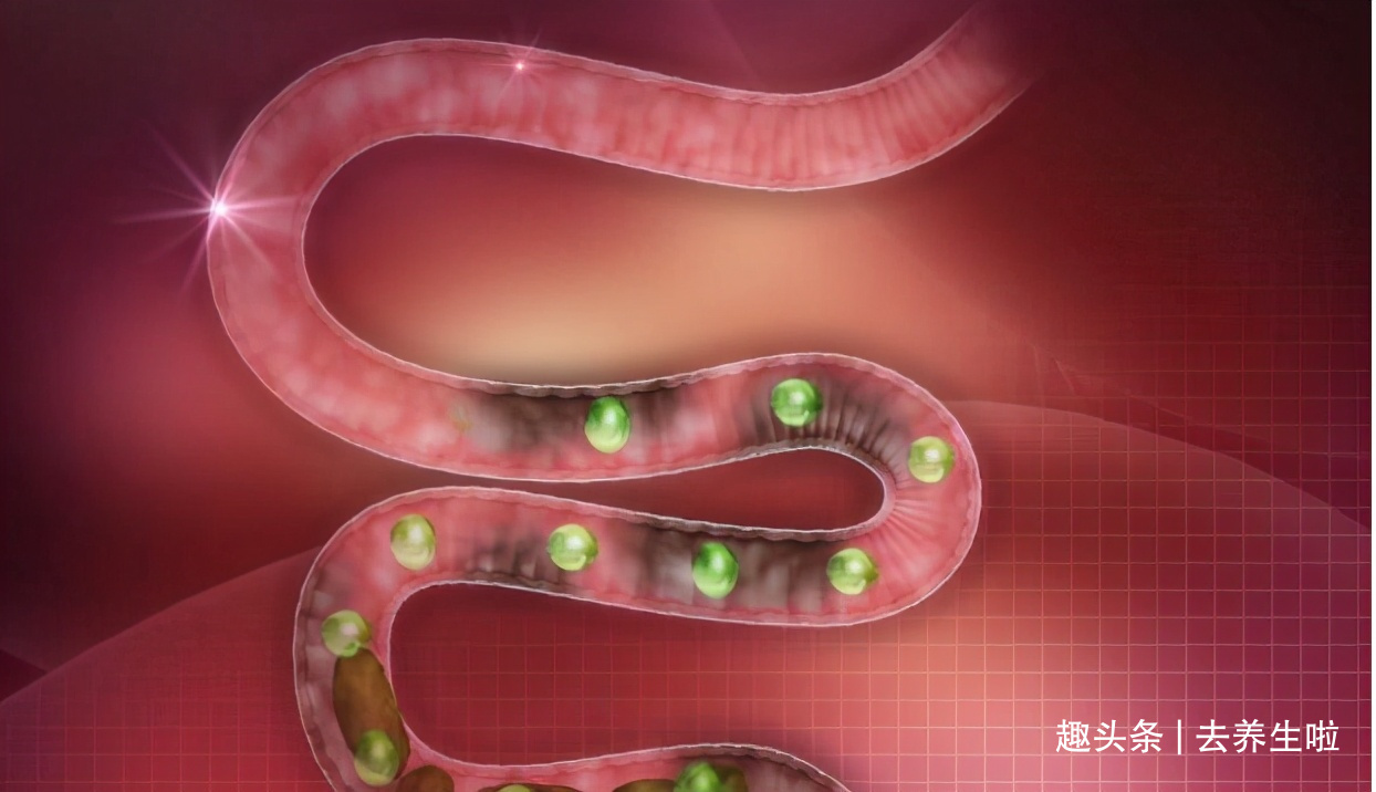 肠道|放屁很多不是肠癌!消化科医生提醒3个信号是关键,很多人不懂