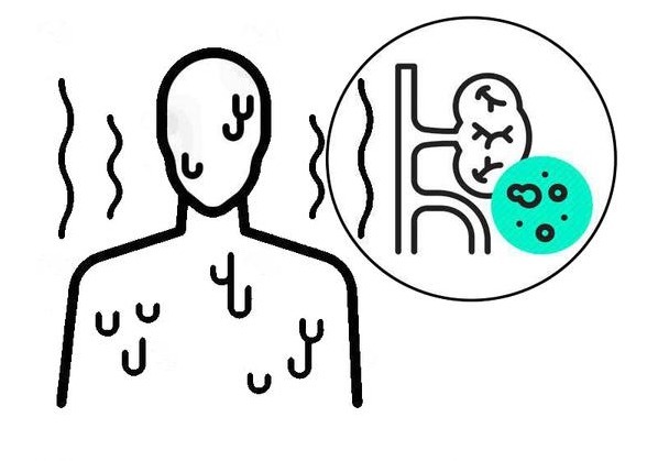 高血压肾病|为什么会出现高血压肾病？不想走向尿毒症，守好这4道防线