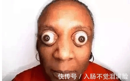 右眼处|直击: 全世界最恐怖的5双“变异”人眼,他的眼会抽烟