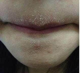 医院|身上出现这6个信号,尽快去医院检查一次肝功能,晚了就后悔吧