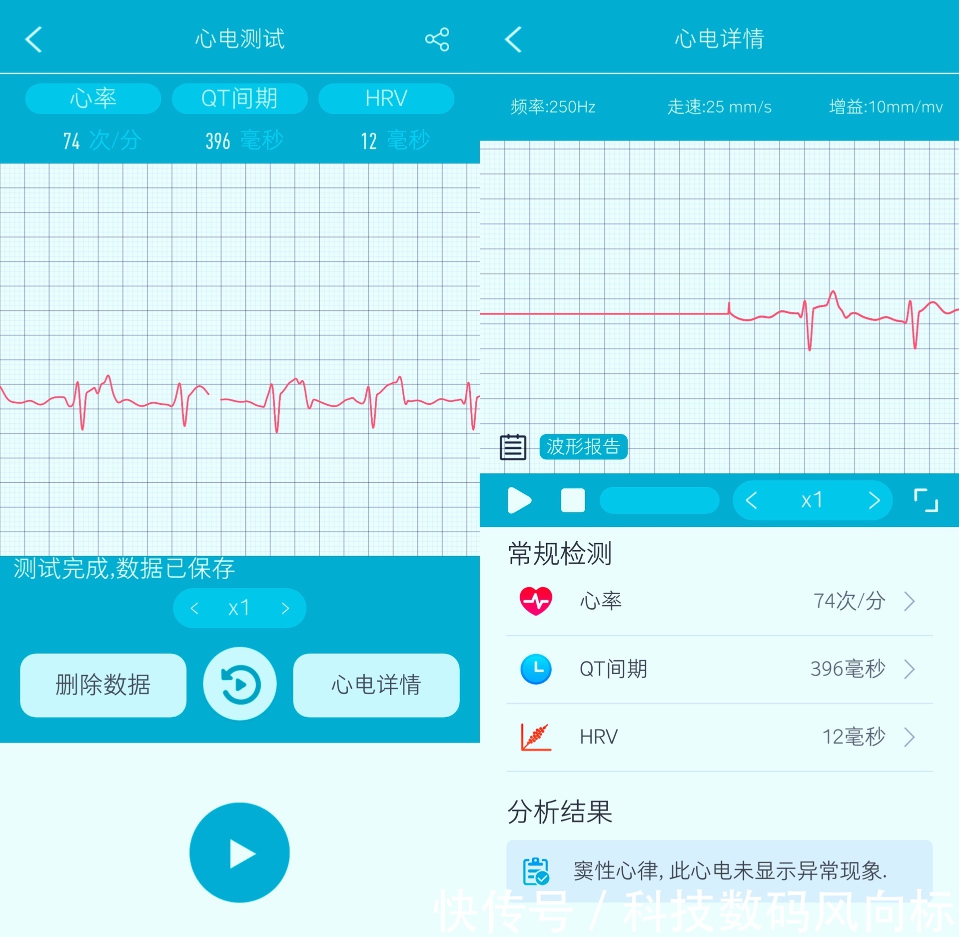 hrv|全天在线的健康小助手，时刻监测身体状况，dido Y1血压心电手环上手