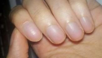 大部分|“月牙”越多，身体越好？大部分人都理解错了，看看自己属于哪种