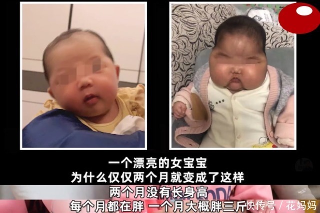 婴儿|“消”字号婴儿霜,致5个月宝宝全身发胖,发育迟缓,脸上长毛