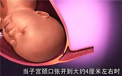 胎头那么大,到底是怎样从那么小的口出来顺产分娩全过程-附图