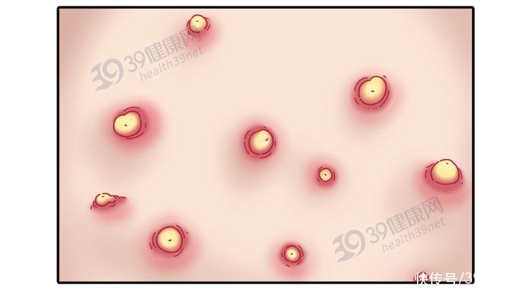 药材|中医2个药材，有效补气排毒，“体毒”没了，便秘等症状就缓解了