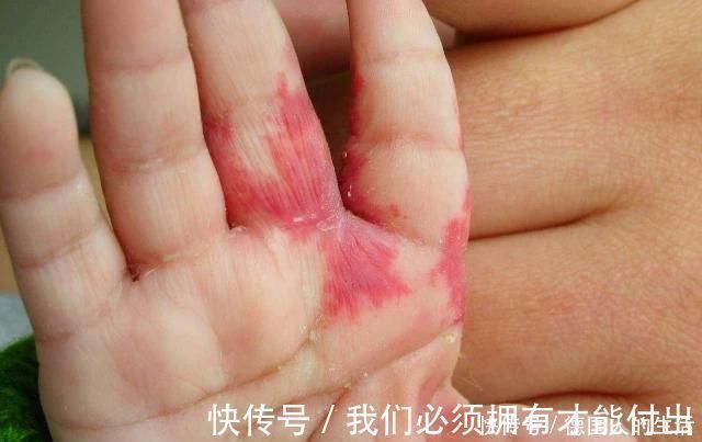 化学物质|孕妈在孕期,尽量不做4件事,避免宝宝脸上长胎记,孕妈别不在意