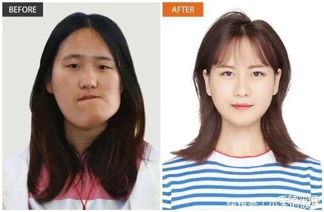 3年花费近百万,整了60次容的“网红”娜娜,现在过得怎么样