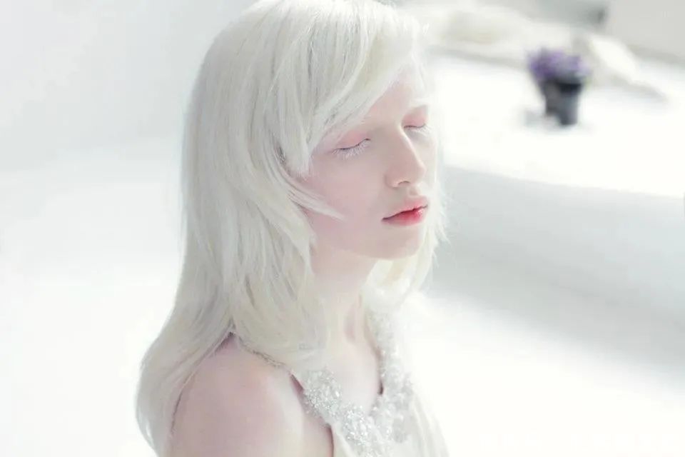 逆袭|因“全身雪白”被遗弃的中国女孩,逆袭成超模的故事让人泪目