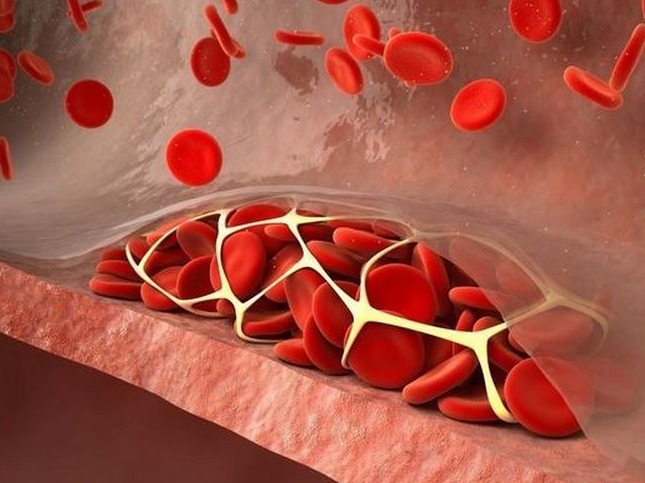 阿司匹林|花生与“此物”同食,远胜“阿司匹林”,坚持吃,远离高血压