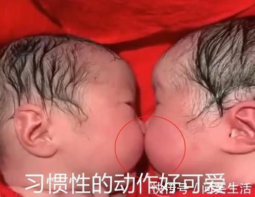 兄妹|龙凤胎兄妹出生后一直亲吻,护士都没法分开,画风太暖心了