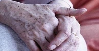 为何年纪大了容易有老年斑,营养专家常吃两物,可能及时避免