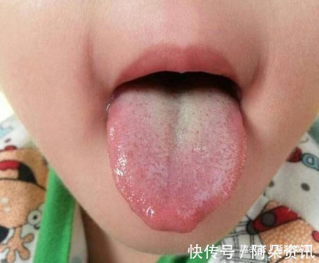 营养不良|4岁女孩因“脾胃衰竭”,却停止发育,儿科大夫怒斥:父母太无知