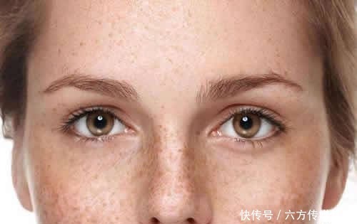 你脸上有色斑吗?别怕!茜茜教你一个科学、专业、实用的祛斑方法