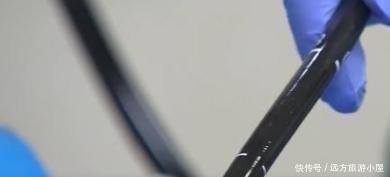 icu|9岁女童腹痛难忍,家长上医院求助,检查结果令人意外