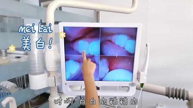 误区|宝宝出牙时,宝妈容易陷入的4个误区,提前学习让娃牙齿更健康