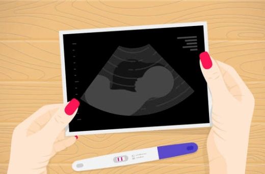 当“意外怀孕”盯上妳时→90%的女性心里都会经历这4步！