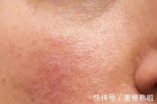 油皮 还在羡慕别人皮肤好护肤品可千万不要跟风,先看这一点!