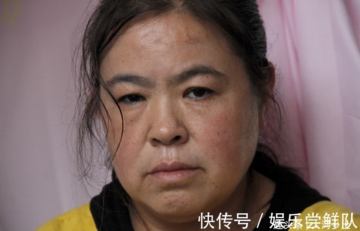 帕金森|女孩长相甜美,因发育迟缓不会说话,妈妈为其日夜操劳患上帕金森