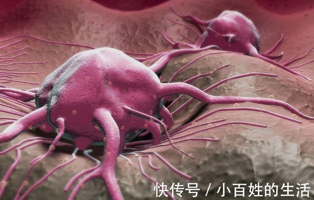 得癌|肿瘤专家此5类人群最易得癌，跟抽烟喝酒者无关