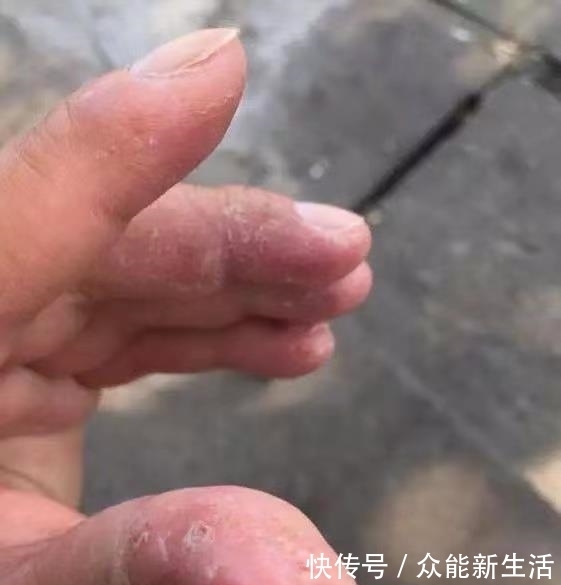 痴迷钓鱼的人,往往会得这几种病,根本改不掉,你中招了吗?