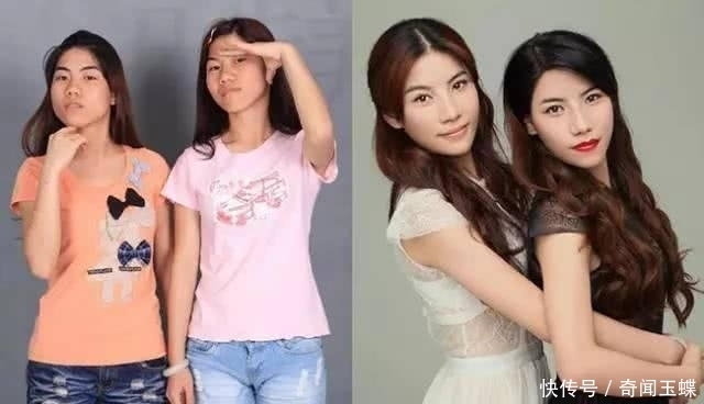 双眼皮|实拍:10张女孩整容前后的对比照,这真就是换了一张脸