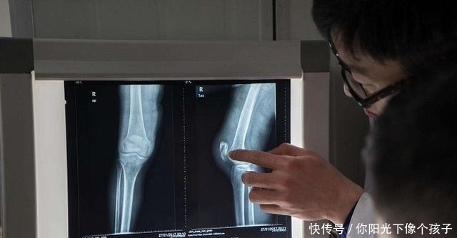 儿童做ct,x光,核磁共振对他们身体生长发育有多大影响?