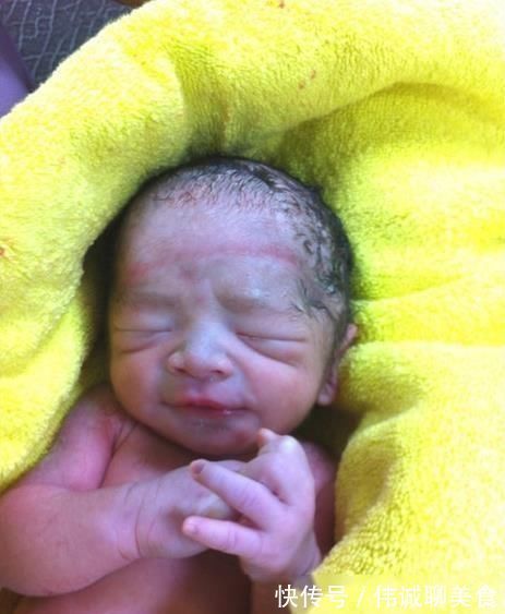 剖腹产|经过了一夜的待产,终于要跟宝贝见面了,我的剖腹产记录