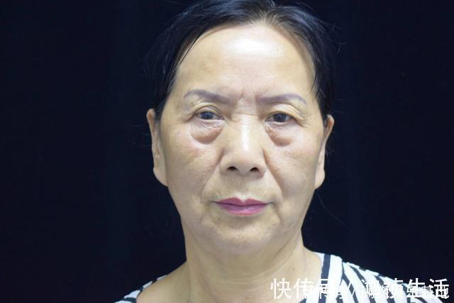 鱼尾纹|女性开始衰老的标志:1处变圆,2处变长,若都不占,说明还年轻