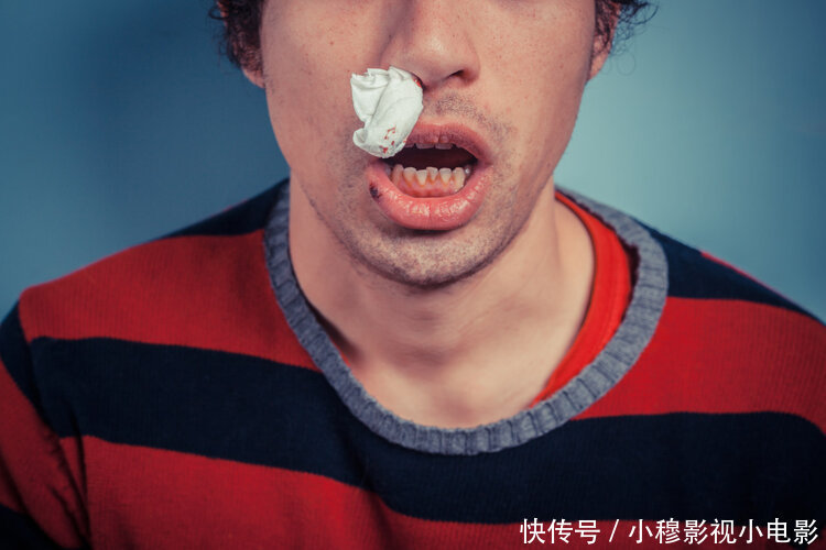 医院|身上无缘无故有淤青,很可能是肝不好!医生提醒:快去医院检查