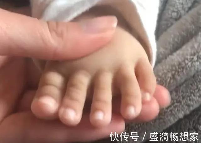脚型|宝宝出生脚趾比手指还长,妈妈高兴不起来,网友基因突变