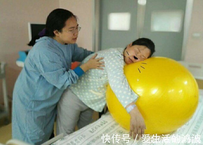 生娃|生娃时“顺”和“剖”哪个更疼?过来人不想重选,理由值得考量