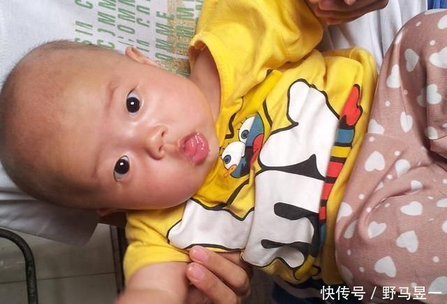 积食|儿科医生平时多摸摸娃这3处,想不聪明都难,以后会感激你