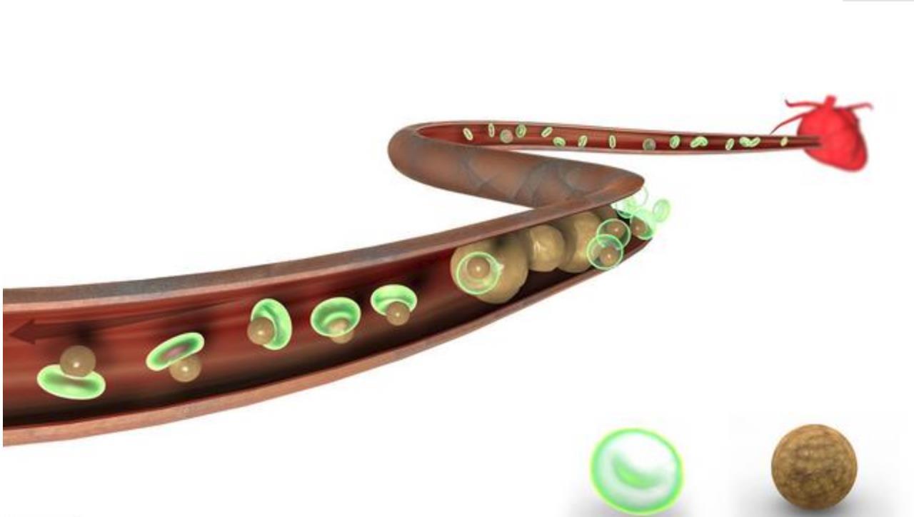 血脂异常|甘油三酯高，什么方法能够迅速减低2个具体实例，教你综合调理